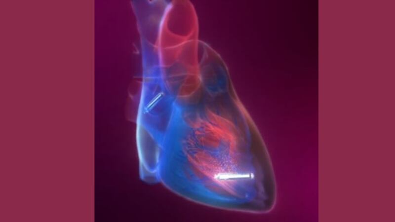 St. Bernards is making history after a patient received a first-of-its-kind dual-chamber...