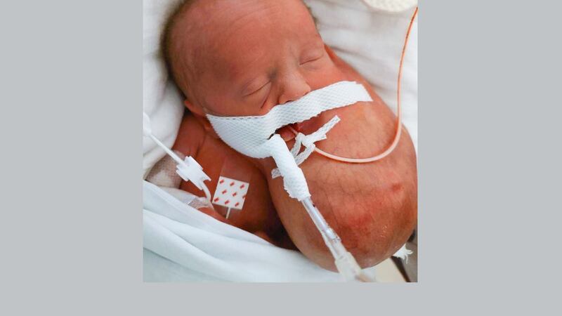 When Layla was born at 33 weeks, the tumor was 17 centimeters, or 6.7 inches, and it was...