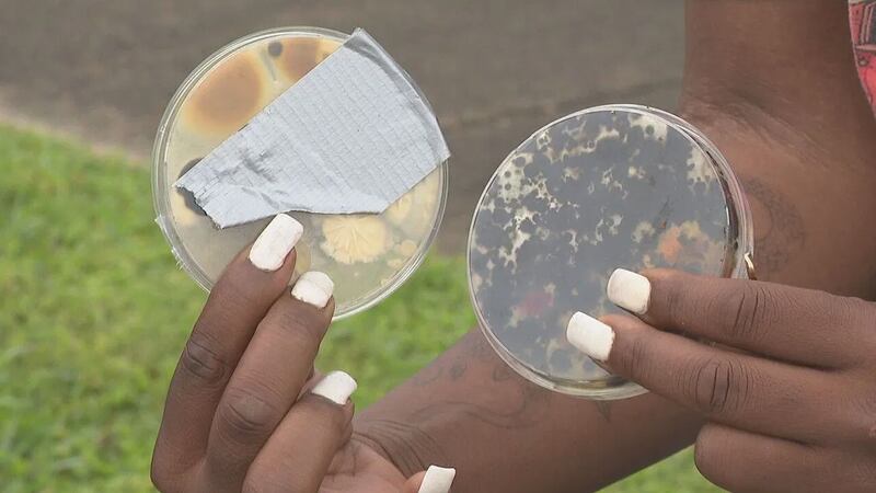 Tenants are fed up after living in an apartment with mold.